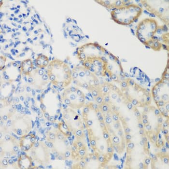 TGM5 / Transglutaminase 5 Antibody