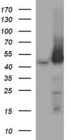 MAP2K1 / MKK1 / MEK1 Antibody (clone OTI5D3)