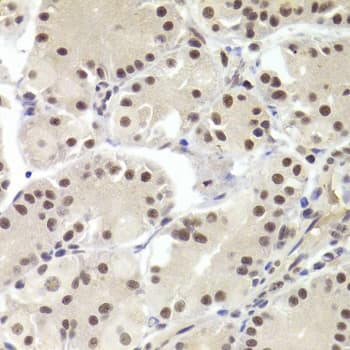 Polyclonal Rabbit anti-Human RBPJ Antibody (IHC, IF, WB)