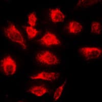 TNFAIP3 / A20 Antibody (Internal)