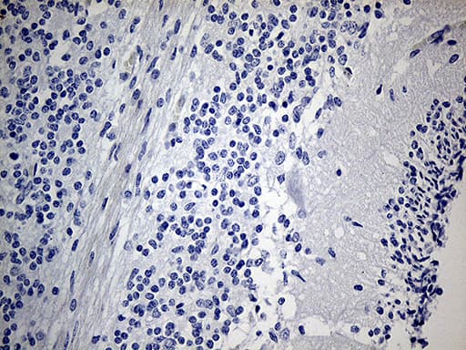 Monoclonal Mouse anti-Human IMP-3 / IGF2BP3 Antibody (clone OTI6A3, IHC, WB)