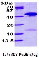 Human TSTA3 / GDP-L-Fucose Synthase Protein (Recombinant His)