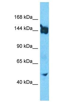 Polyclonal Rabbit anti-Human SLIT3 Antibody (aa226-275, WB)