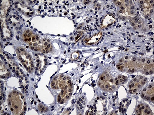 Monoclonal Mouse anti-Human WASL / N-WASP Antibody (clone OTI6A4, Carrier-free, IHC, WB)