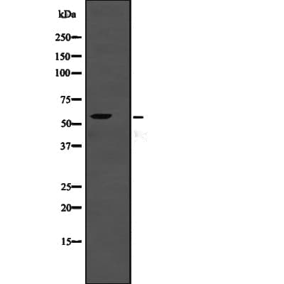 TSEN2 Antibody