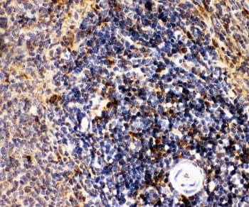 Polyclonal Rabbit anti-Human MME / CD10 Antibody (aa52-750, IHC, WB)