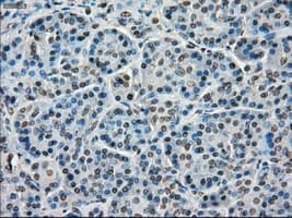 TMEM100 Antibody (clone OTI1F8)