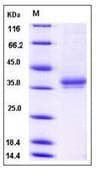 Human IGSF11 / VSIG3 Protein (Recombinant His,C-terminus)