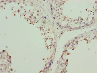 ZNF264 Antibody