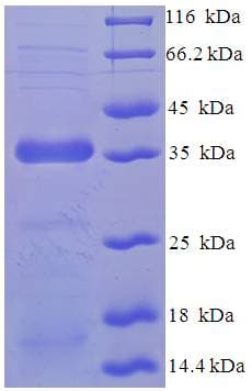 Human PTPMT1 Protein (Recombinant His-SUMO)