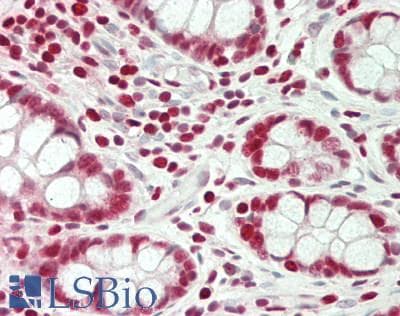 IHC-plus™ MYB / c-Myb Antibody (N-Terminus)