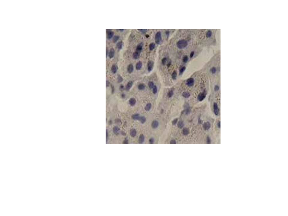 IL6 / Interleukin 6 Antibody