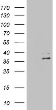 EBLN2 / FLJ10213 Antibody (clone OTI1B5)