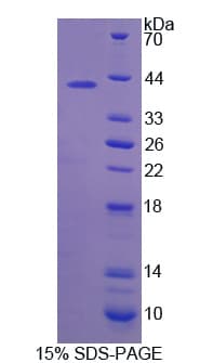 Rat SORD / Sorbitol Dehydrogenase Protein (Recombinant His)