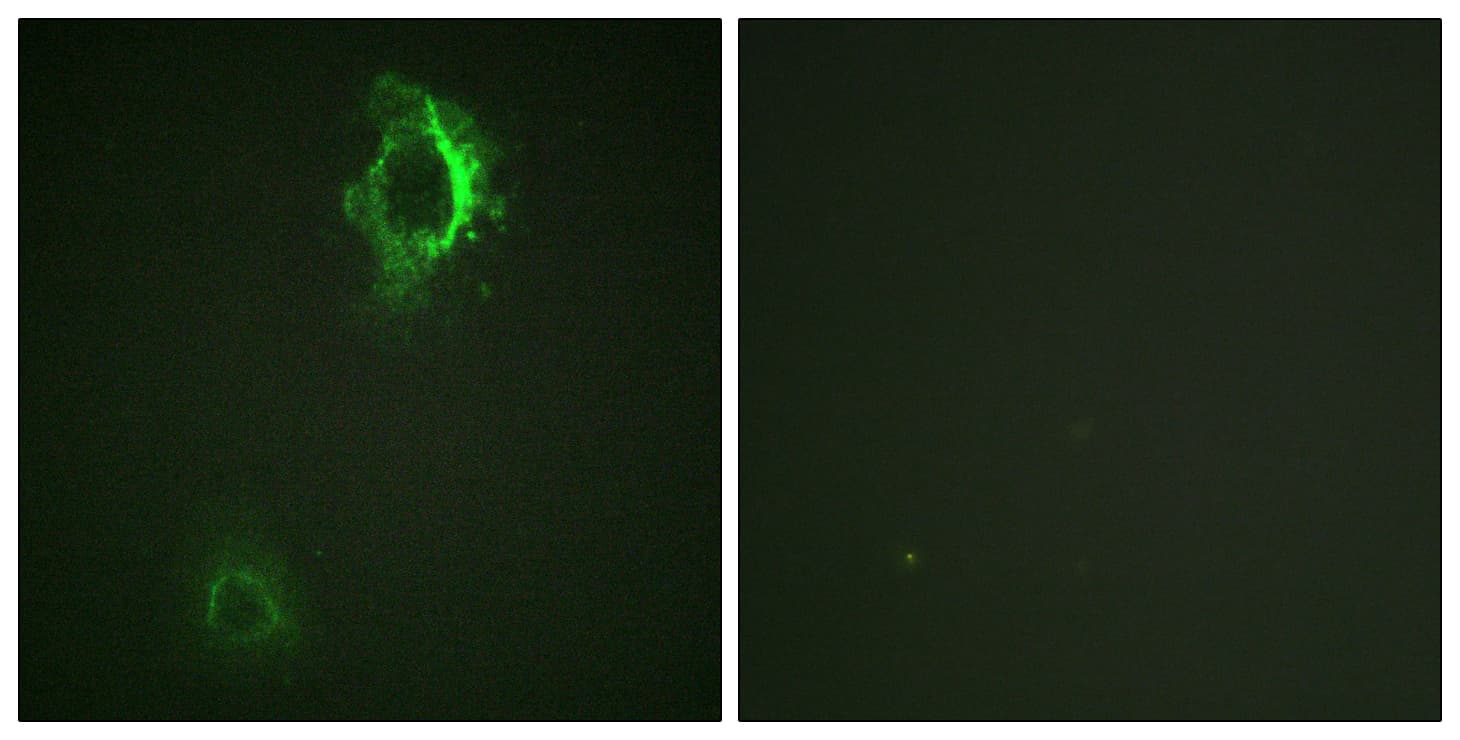 Polyclonal Rabbit anti-Human CD5 Antibody (phospho-Tyr453, IF, WB)