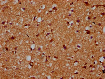 Polyclonal Rabbit anti-Human CDS2 Antibody (IHC, WB)