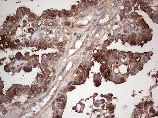 Monoclonal Mouse anti-Human LGALS3 / Galectin 3 Antibody (clone OTI15E4, IHC, WB)