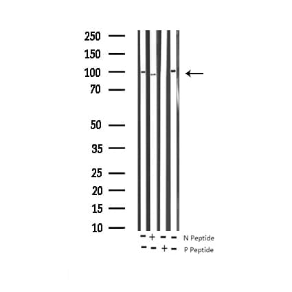 Polyclonal Rabbit anti-Human DNM1 / Dynamin Antibody (phospho-Ser774, IHC, WB)