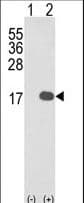 IL36B Antibody (aa1-30)