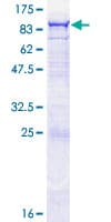 Human OAS2 Protein (Recombinant GST)