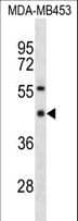 YY1 Antibody (aa210-239)