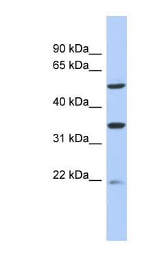SLC22A24 Antibody (C-Terminus)