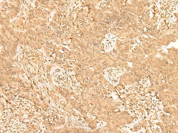 ST8SIA4 Antibody