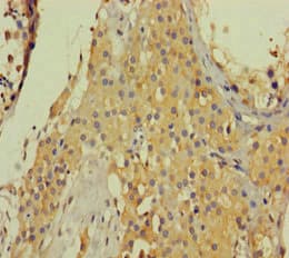 COL6A6 Antibody (aa430-982)