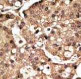 AUTL1 / ATG4C Antibody (aa419-448)