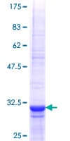 Human TLL1 Protein (Recombinant GST, N-terminus)