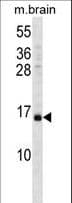 VAMP3 / VAMP-3 Antibody (aa15-43)