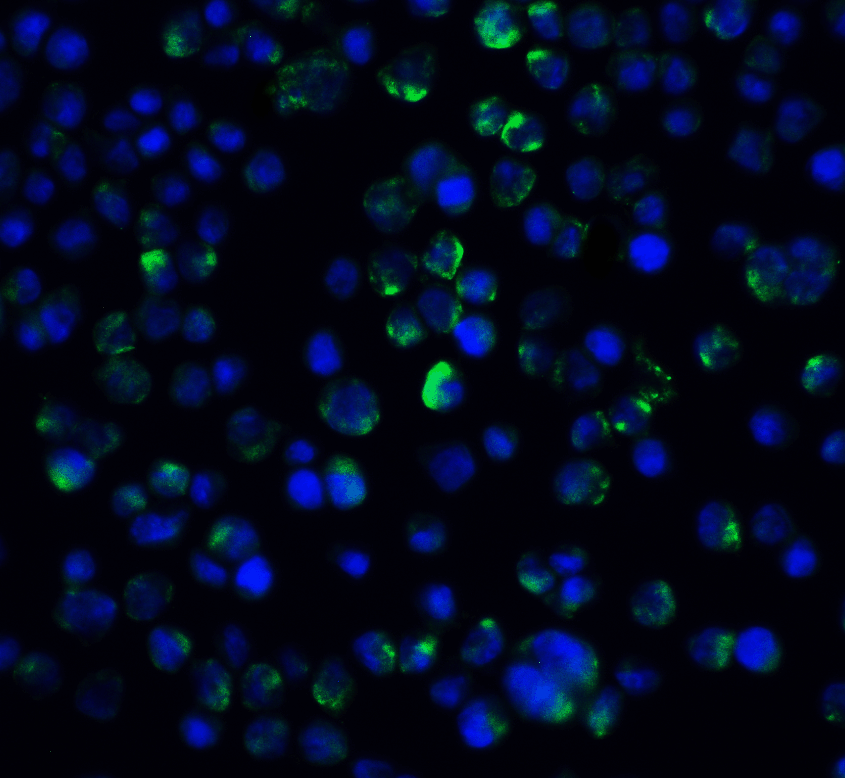 Polyclonal Rabbit anti-Human IL21 Receptor Antibody (IF, WB)