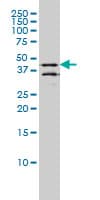 IHC-plus™ Requiem / DPF2 Antibody (clone 2F6)