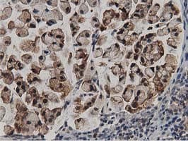 ACAT2 Antibody (clone OTI7B1)