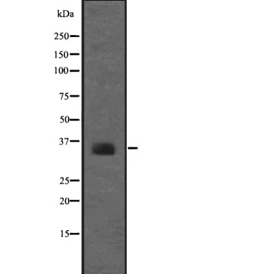 RPSA / Laminin Receptor Antibody
