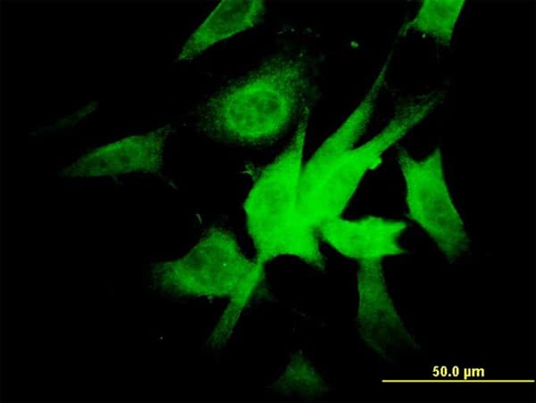 NDUFA9 Antibody (clone 3D7)