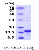 Human BOLA3 Protein (Recombinant His)