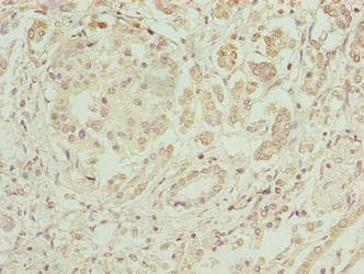 Polyclonal Rabbit anti-Human ERO1LB Antibody (IHC, WB)