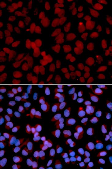 TNFAIP3 / A20 Antibody