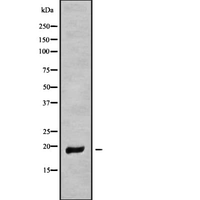 MT-ND6 Antibody