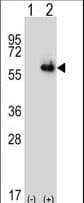 Polyclonal Rabbit anti-Human P5CDH / ALDH4A1 Antibody (aa288-314, IHC, WB)