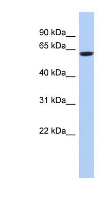 Polyclonal Rabbit anti-Human CAMKV Antibody (aa35-84, WB)