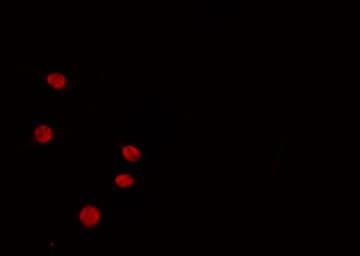 Polyclonal Rabbit anti-Human CREBBP / CREB Binding Protein Antibody (IHC, IF, WB)