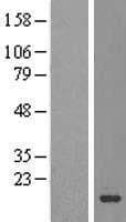 Human SZRD1 / C1orf144 Protein (Over-Expression Lysate Myc-DDK (Flag))