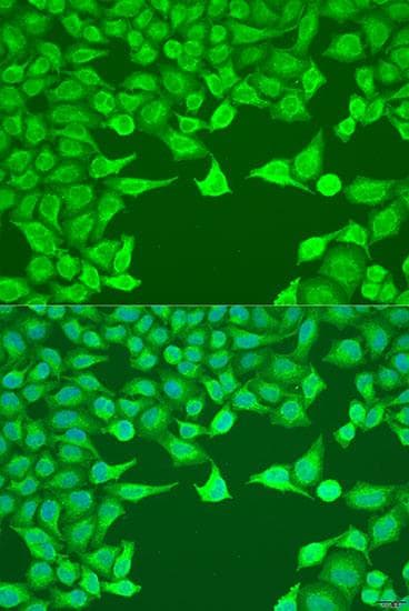 ATG9A Antibody