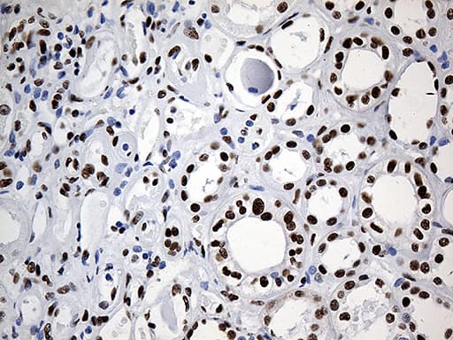 HNRNPH1 / hnRNP H Antibody (clone OTI5D11)