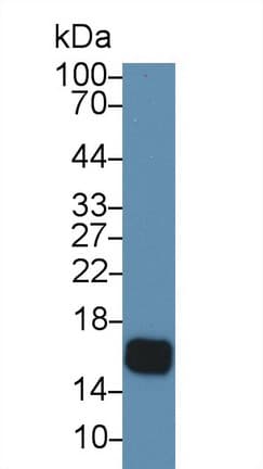 CST5 Antibody (aa21-142)