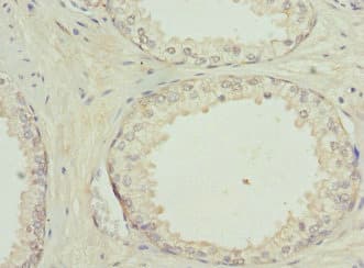 GPBB / PYGB Antibody