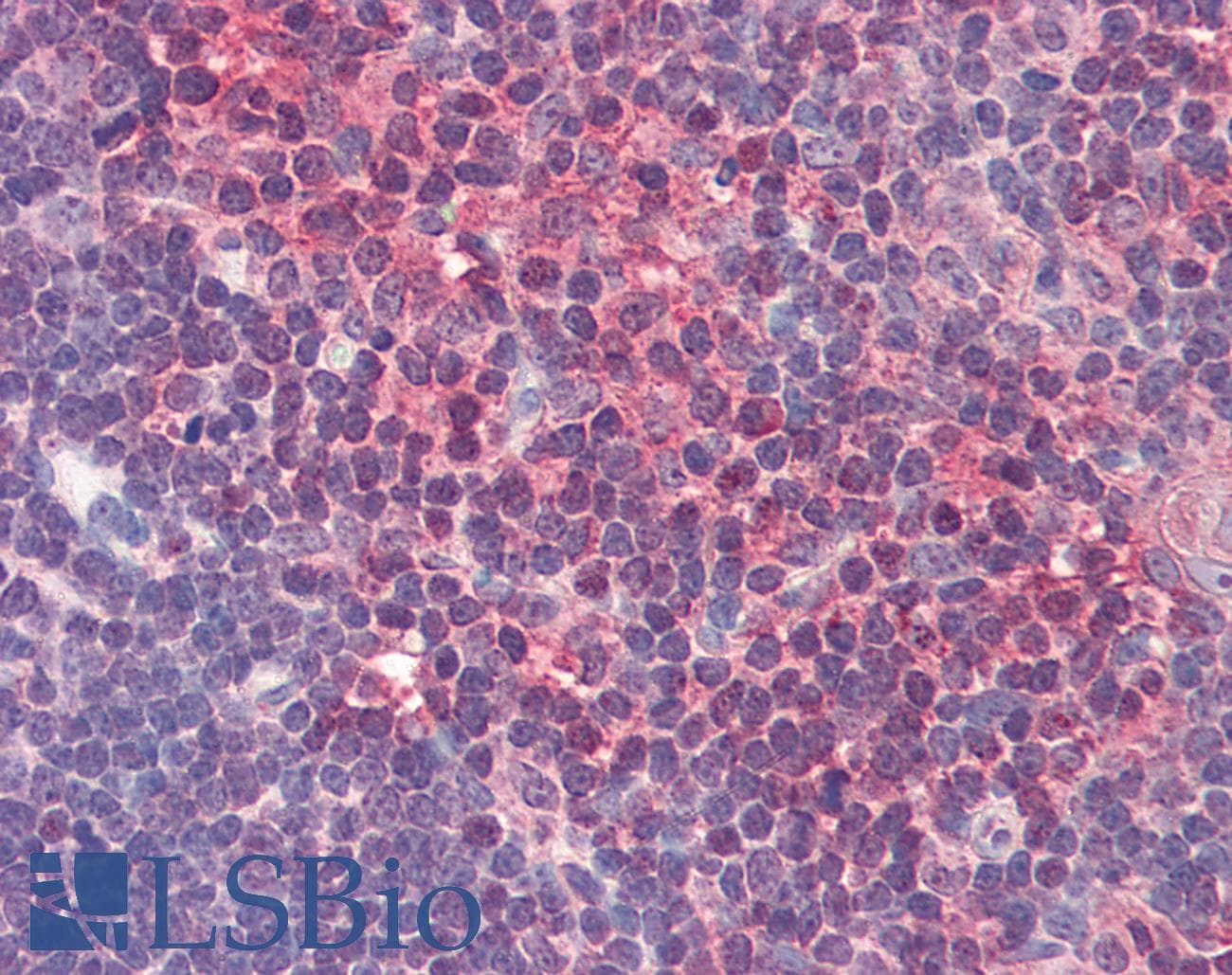 IHC-plus™ HPGDS Antibody