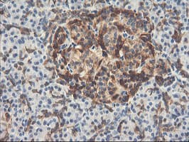 PFKP Antibody (clone OTI2E8, Carrier-free)